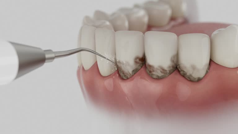 Trusted Tooth Extraction service in Basehor, KS - Dentist Open Now